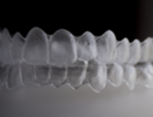 Invisalign